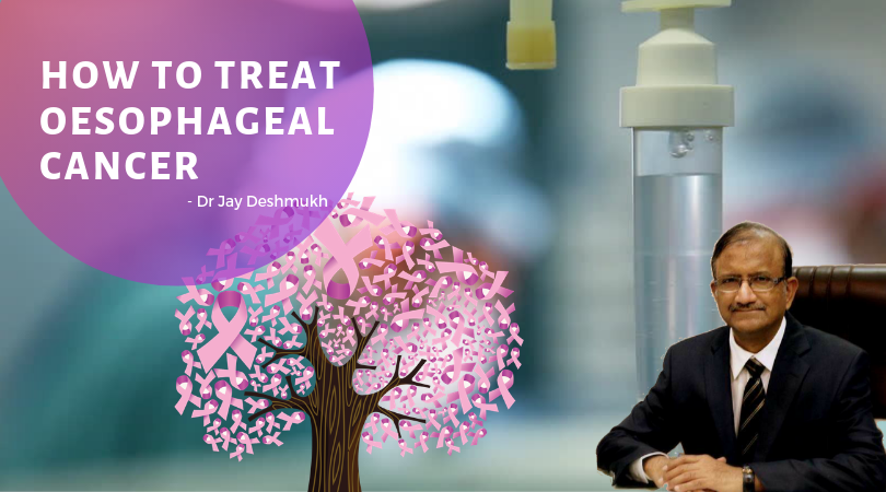 Oesophageal Cancer Treatment | Sunflower Hospital Nagpur | Dr Jay Deshmukh