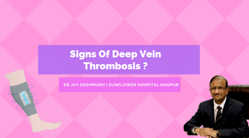 What is Deep Vein Thrombosis ? | Sunflower Hospital Nagpur