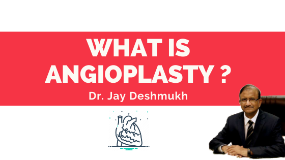 WHAT IS ANGIOPLASTY ? | Dr Jay Deshmukh
